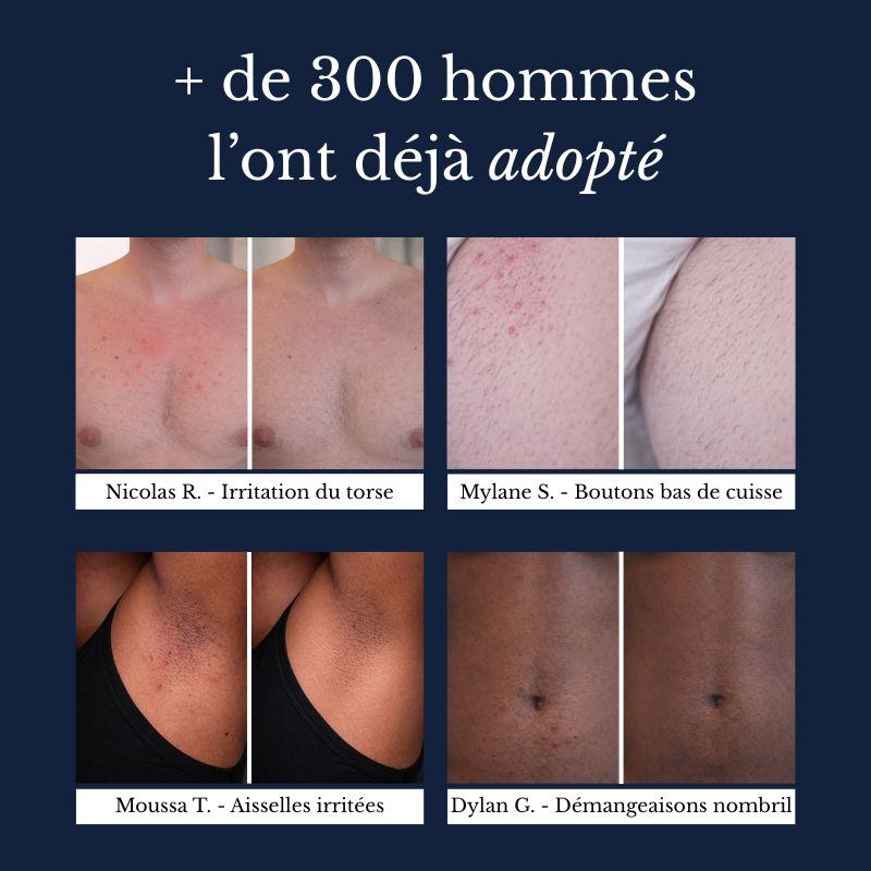 Tondeuse Intime MAN TRIM